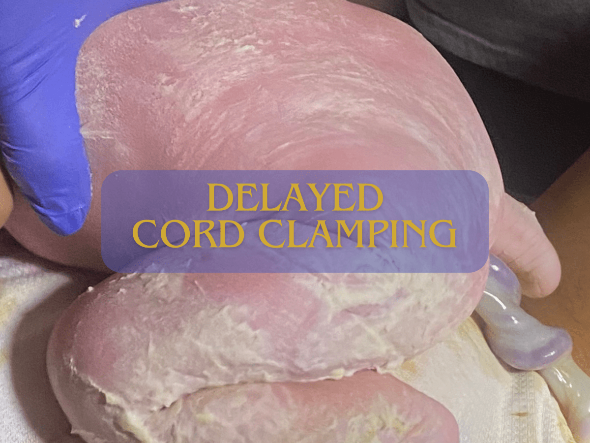 Delaying Cord Clamping