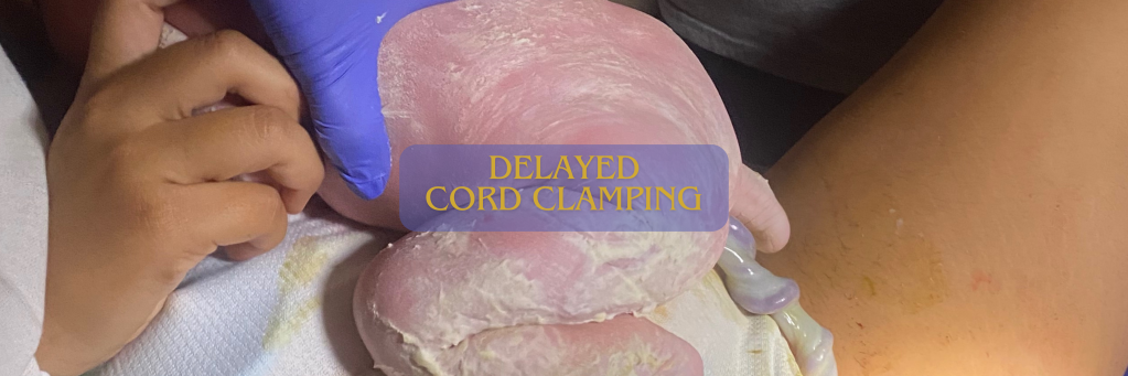 Delaying Cord Clamping